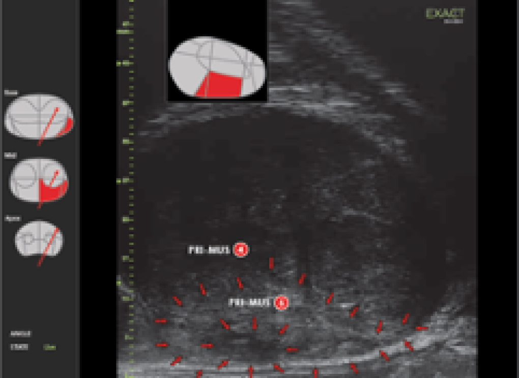 Exact Imaging in use